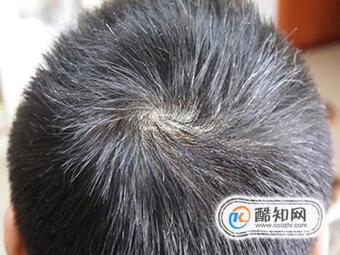 ���ͷ�Է��ʵĸı�����